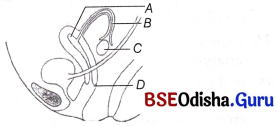 CHSE Odisha Class 12 Biology Important Questions Chapter 3 Human Reproduction 3